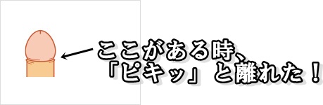 亀頭と包皮がはがれた